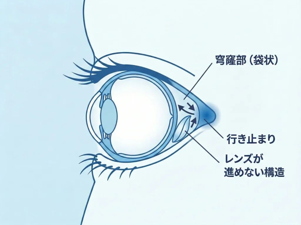 目の裏側に入らない理由