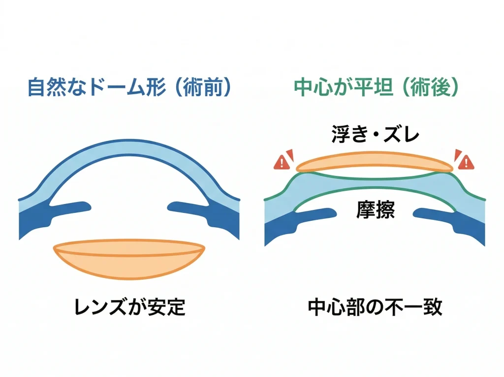 角膜形状オブレートの影響