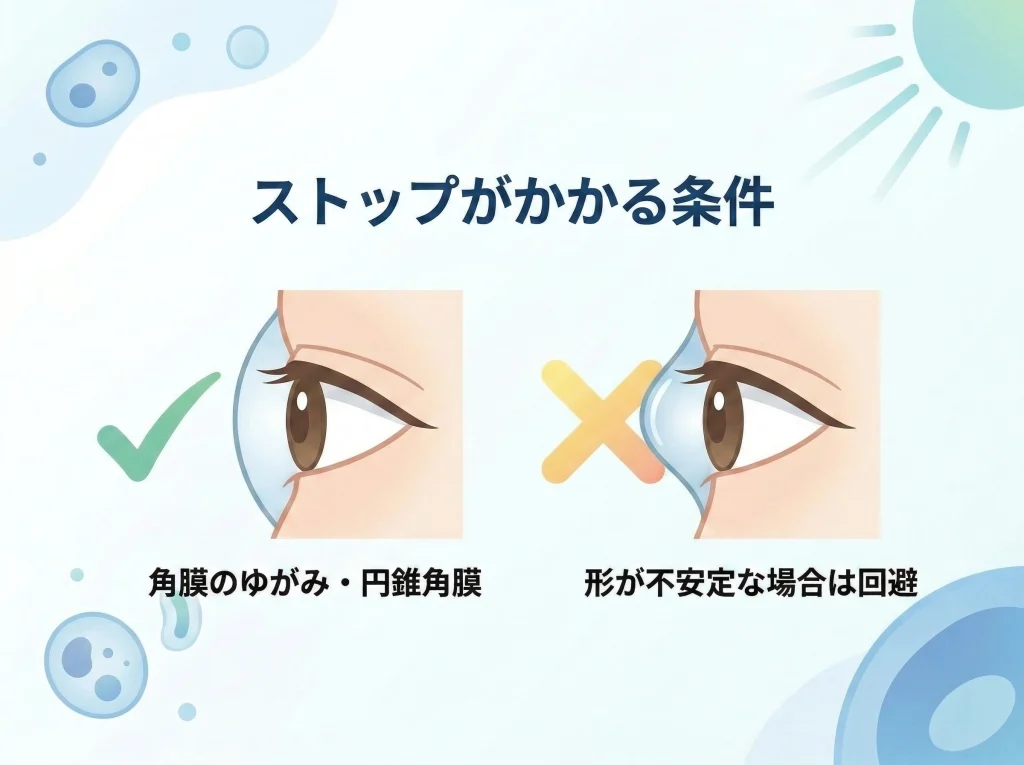 円錐角膜と不正乱視の注意